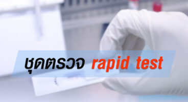 ชุดตรวจ rapid test เป็นอย่างไร