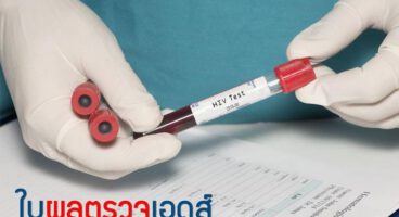 ใบ ผลตรวจเอดส์ วิเคราะห์ผลตรวจเลือดเอชไอวี