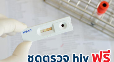 ชุดตรวจ hiv ฟรี ไปรับได้ที่ไหนบ้าง ?