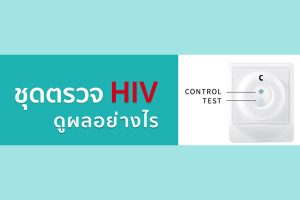 ชุดตรวจ HIV ดูยังไง อ่านผลและแปลความหมายอย่างไร
