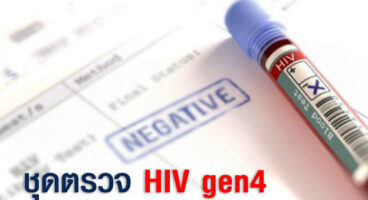 ชุดตรวจ hiv gen4 เป็นอย่างไร ดีกว่าการตรวจคัดกรองเอชไอวีด้วยวิธีอื่นไหม