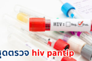 ชุดตรวจ HIV pantip รวมคำถาม และคำตอบ ของเพื่อน ๆ ในพันทิป